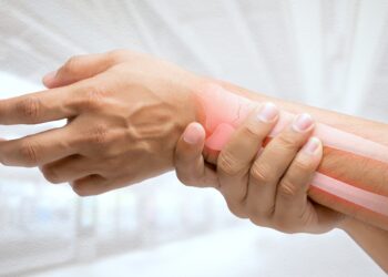 Osteoporose: Natürliche Cumarine als effektive Behandlungsoption – Heilpraxis