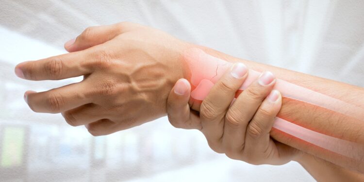 Osteoporose: Natürliche Cumarine als effektive Behandlungsoption – Heilpraxis