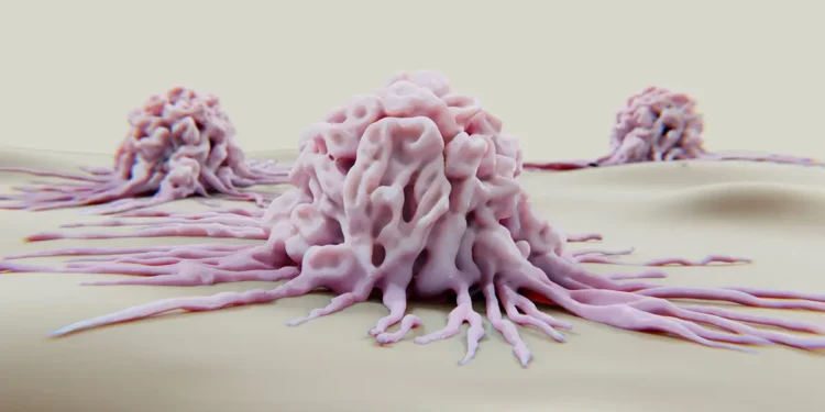 Krebsversorgung in der Krise: Lancet Oncology-Kommission warnt vor Personalmangel – News – Deutsches Ärzteblatt